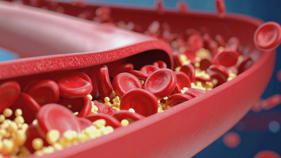 Does Calcium Cause Calcification? Understanding the Real Science Behind Calcium, Arteries, and Bone Health