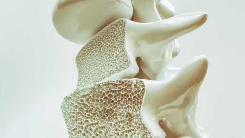 The Ultimate Guide to Osteoporosis Meds: Benefits, Risks, and What to Know Before Choosing a Treatment
